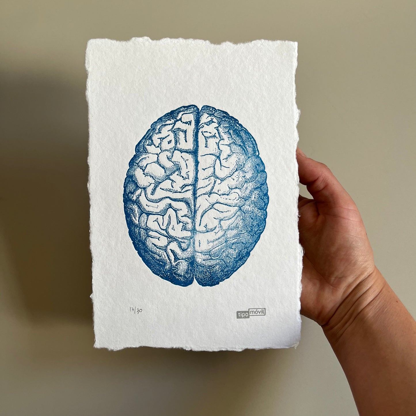 Cerebro